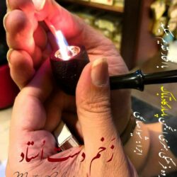 قطعه دکلمه زخم دست استاد